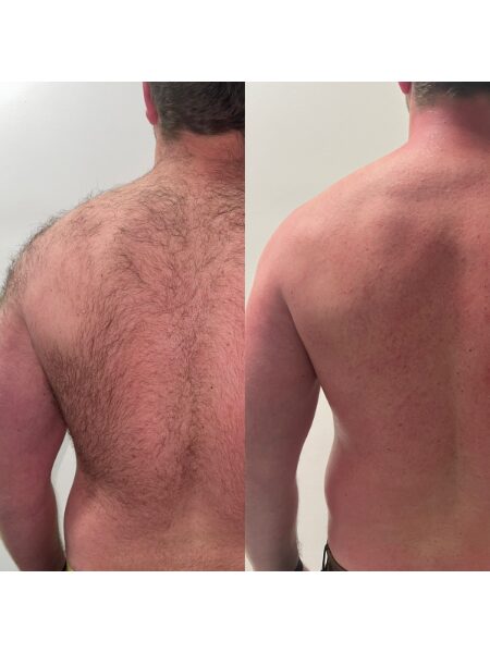 Waxing before and after