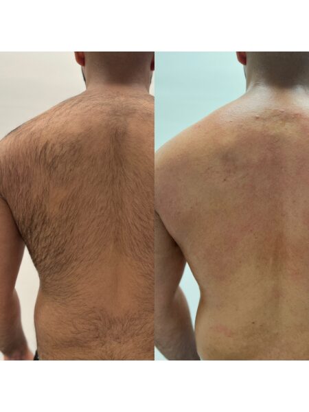 Waxing before and after