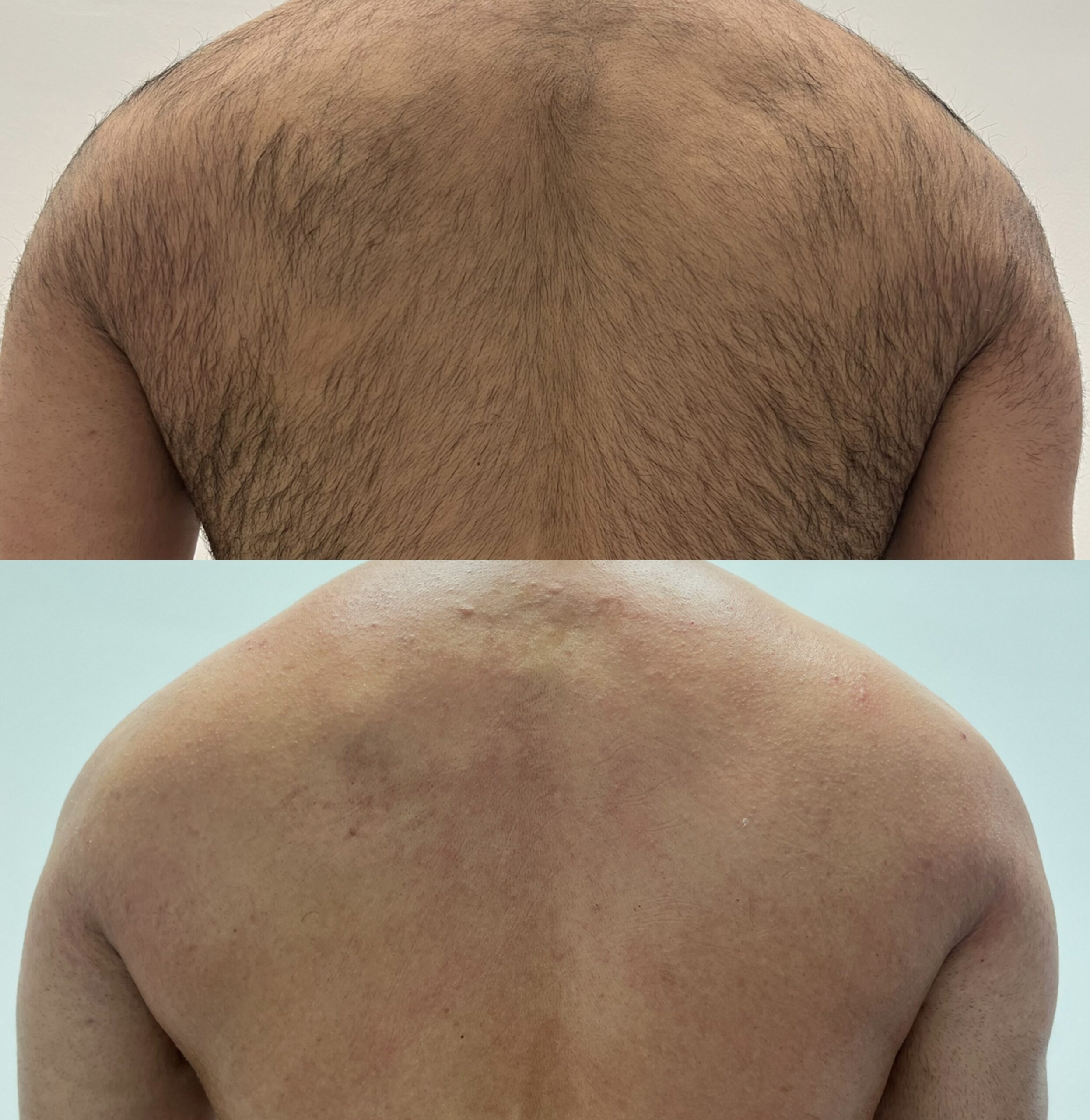 Waxing before and after