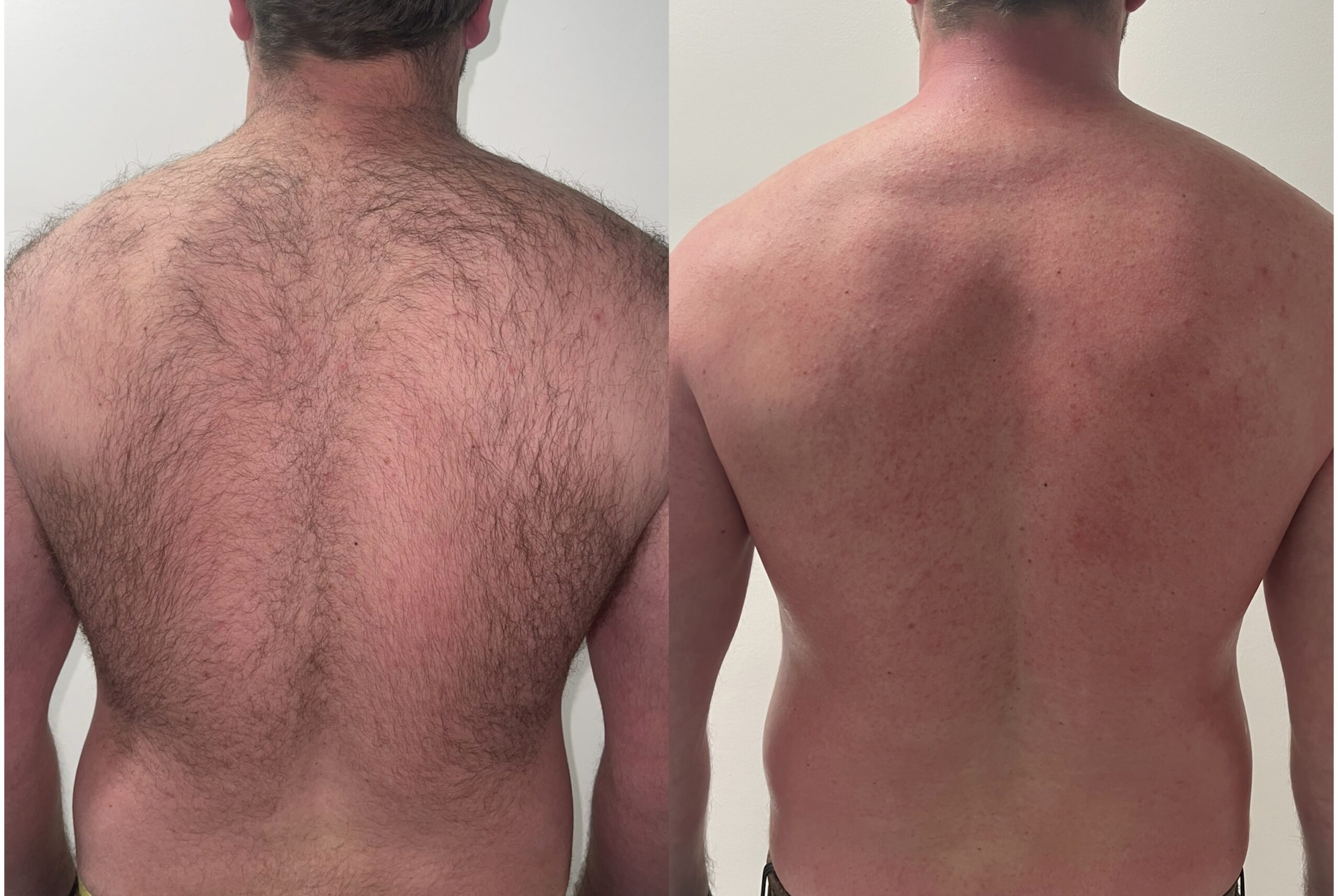 Waxing before and after